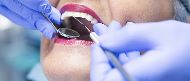 Best Knocked-Out Tooth Emergency  in Summerlin South, NV